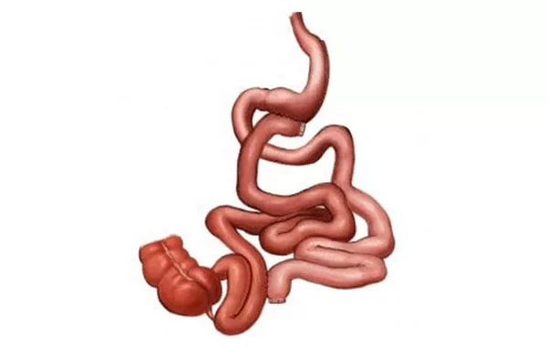 Transit Bipartisyon Ameliyatı