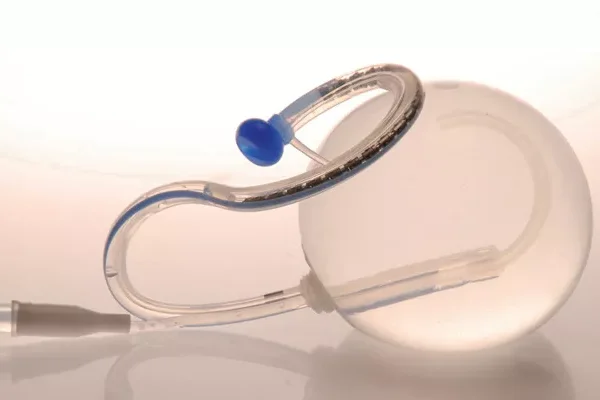 12 Aylık Mide Balon Nedir? Nasıl Uygulanır?