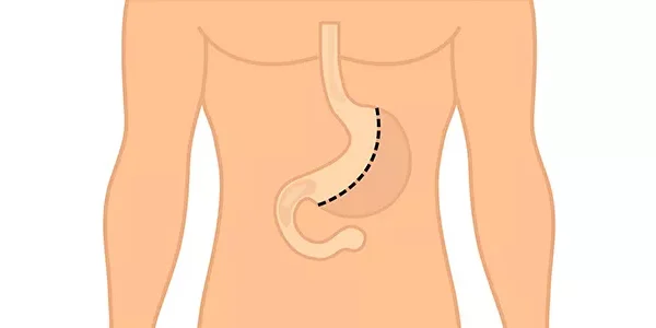 Bariatrik Cerrahiye Uygun Bitkisel Protein Kaynakları