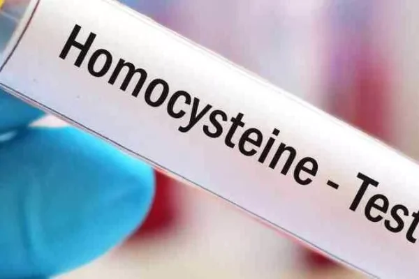 Homosistein nedir?